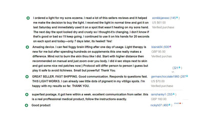 Psoriasis Eczema Vitiligo treatment USB lamp